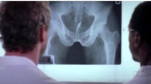 candiru catfish xray