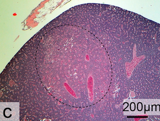 Image of liver removed from a Japanese medaka fed plastics with absorbed toxins. Circled in black is a tumor that developed during the experiment (see light pink coloration). Image via Scientific Reports/Rochman et. al.
